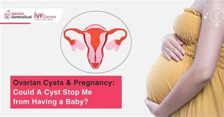 Can I get pregnant with ovarian cyst?