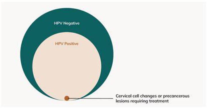 Can persistent HPV go away?