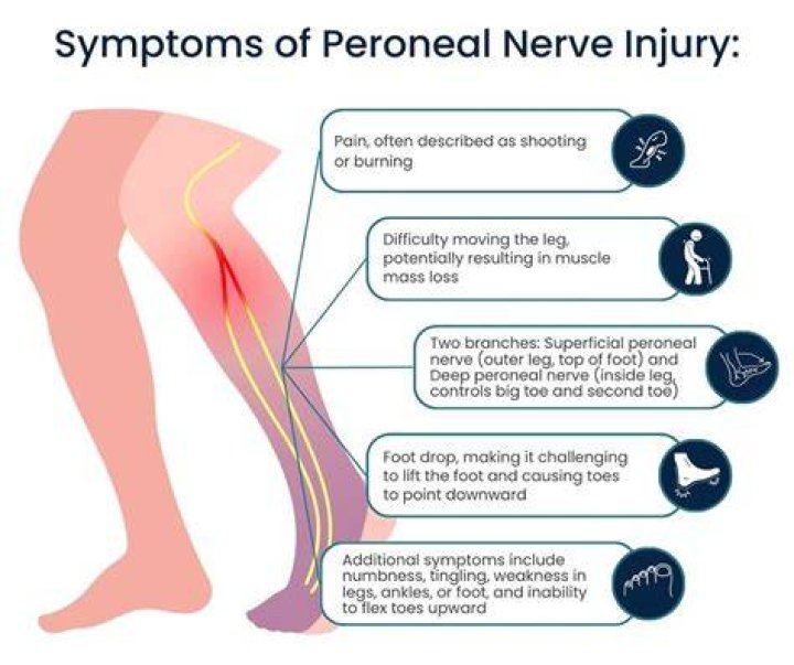 How do you treat nerve pain in your leg?