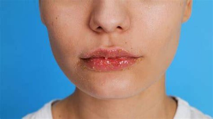 Why do lips turn red?